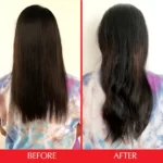 قبل و بعد استفاده هیرتامین مکمل تقویتی مو